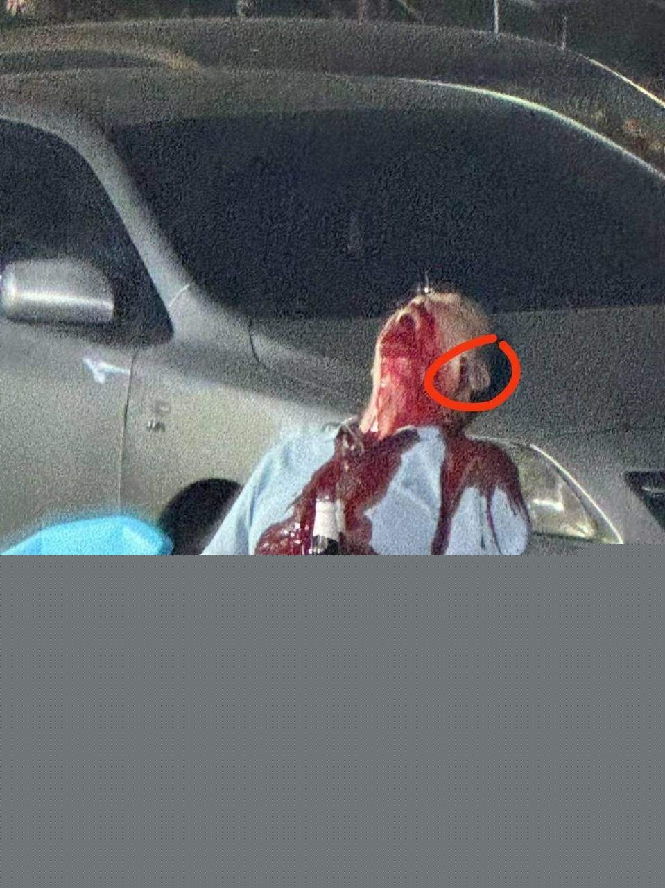 武汉烧烤摊枪击案 10 武汉烧烤摊枪击案 10