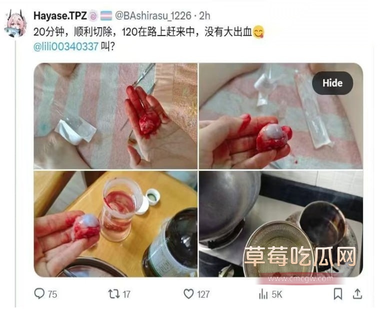 推特伪娘用刀片把蛋蛋给割下来 5 推特伪娘用刀片把蛋蛋给割下来 5
