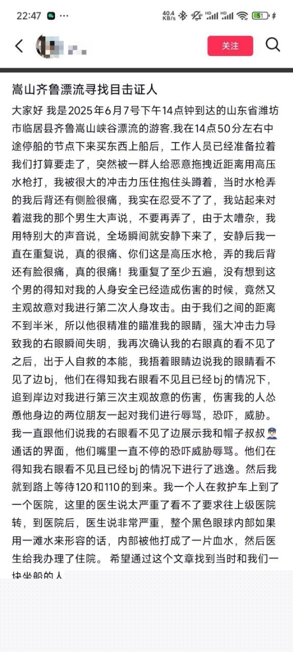 高压水枪射伤眼睛。1 高压水枪射伤眼睛。1