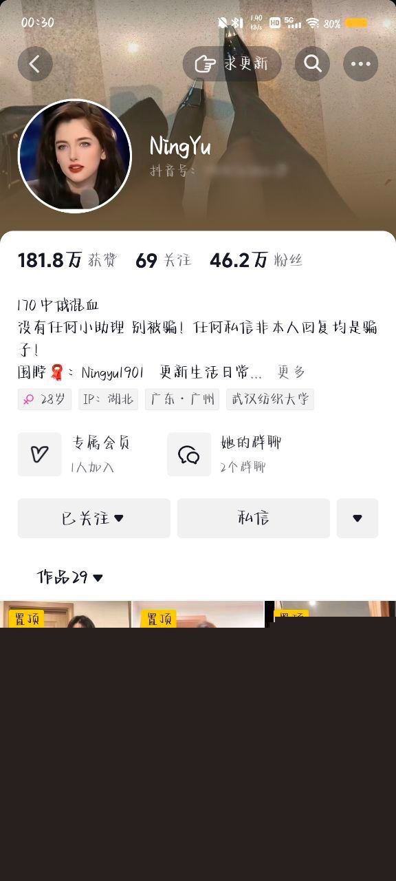 抖音混血女神NingYu1 抖音混血女神NingYu1