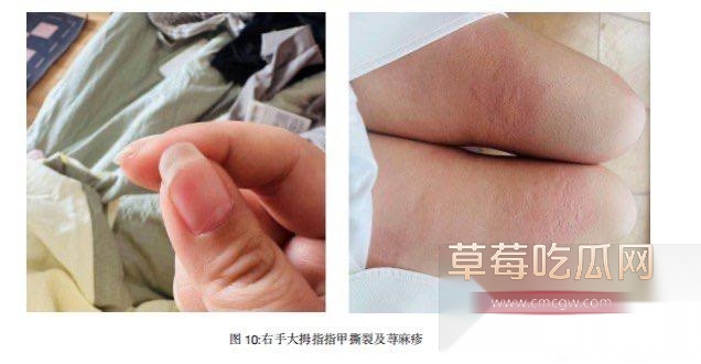 B站女员工维权控告在出差三亚时 被国家消防救援系统干部强奸 但其2小时发生两次关系 让检方认为系自愿 不予起诉! 3 B站女员工维权控告在出差三亚时 被国家消防救援系统干部强奸 但其2小时发生两次关系 让检方认为系自愿 不予起诉! 3