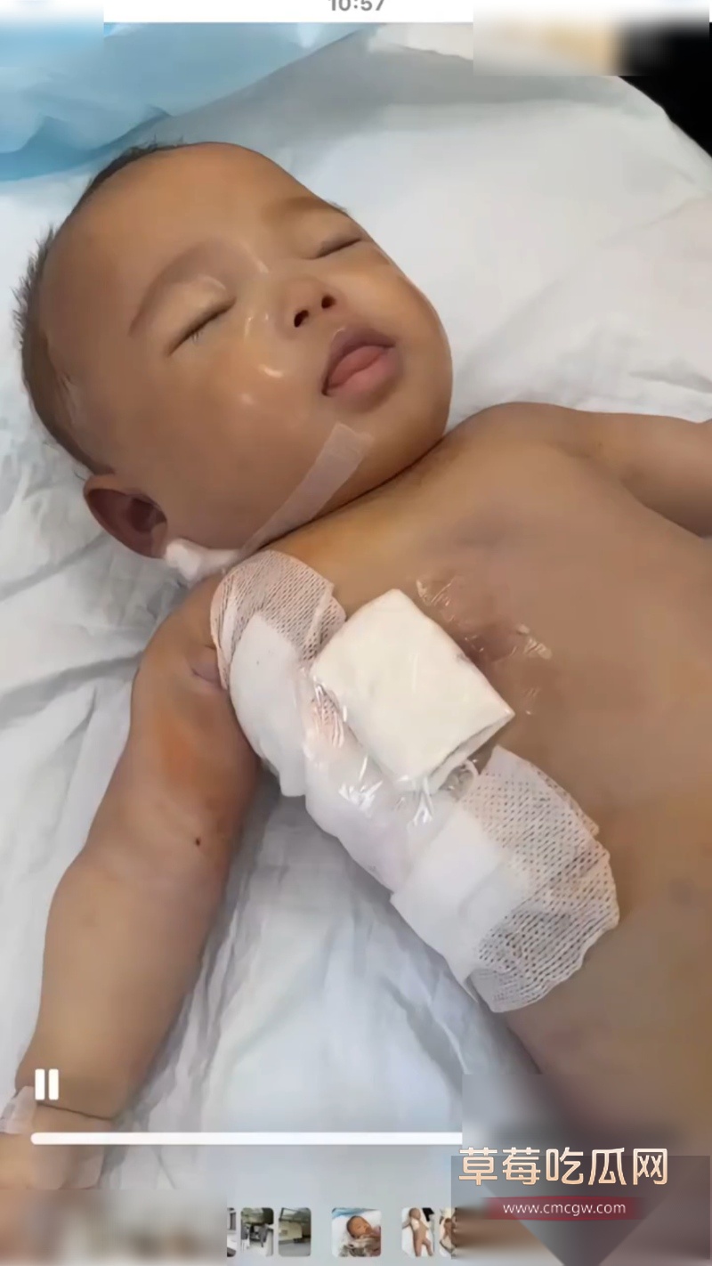 浙江宁波5月龄早产女婴 9 浙江宁波5月龄早产女婴 9