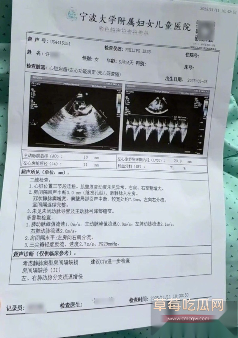 浙江宁波5月龄早产女婴 15 浙江宁波5月龄早产女婴 15
