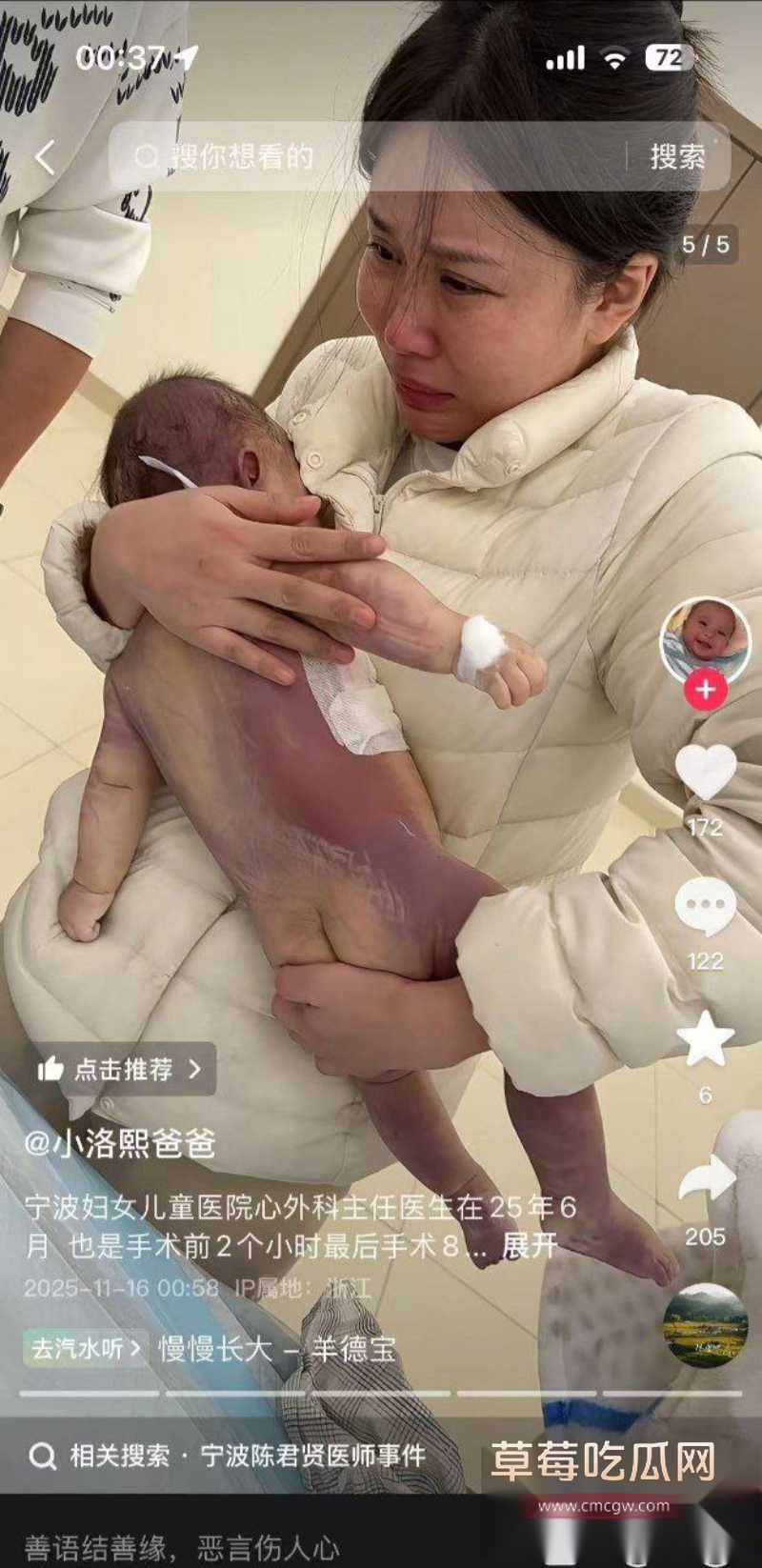 浙江宁波5月龄早产女婴 18 浙江宁波5月龄早产女婴 18