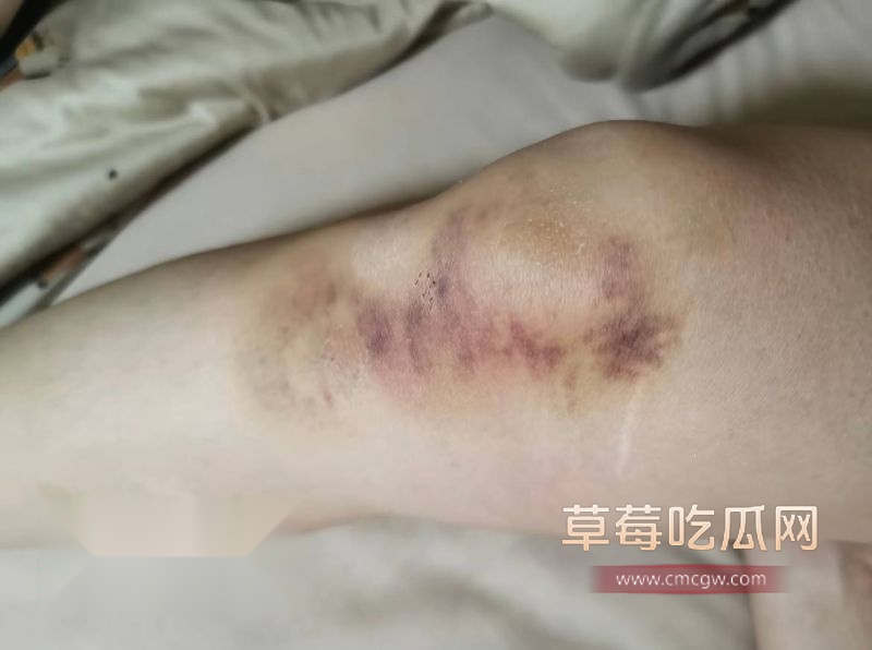 抖音女网红娜姐重生被丈夫高飞家暴3