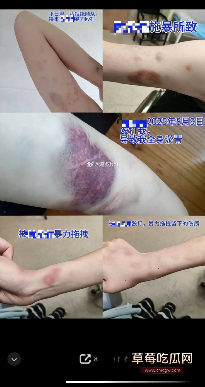 莆田涵江塘头学校老色鬼领导强上刚开腹女生 4 莆田涵江塘头学校老色鬼领导强上刚开腹女生 4