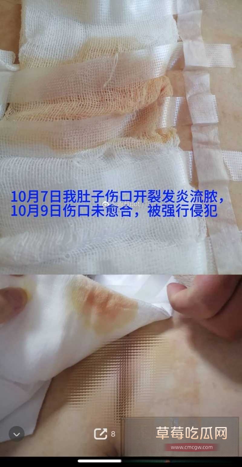 莆田涵江塘头学校老色鬼领导强上刚开腹女生 5 莆田涵江塘头学校老色鬼领导强上刚开腹女生 5
