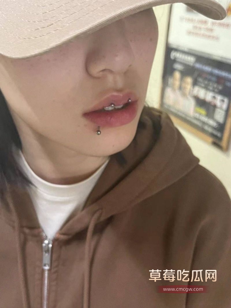 墨尔本工地黄毛男Tonmy传染疱疹2 墨尔本工地黄毛男Tonmy传染疱疹2