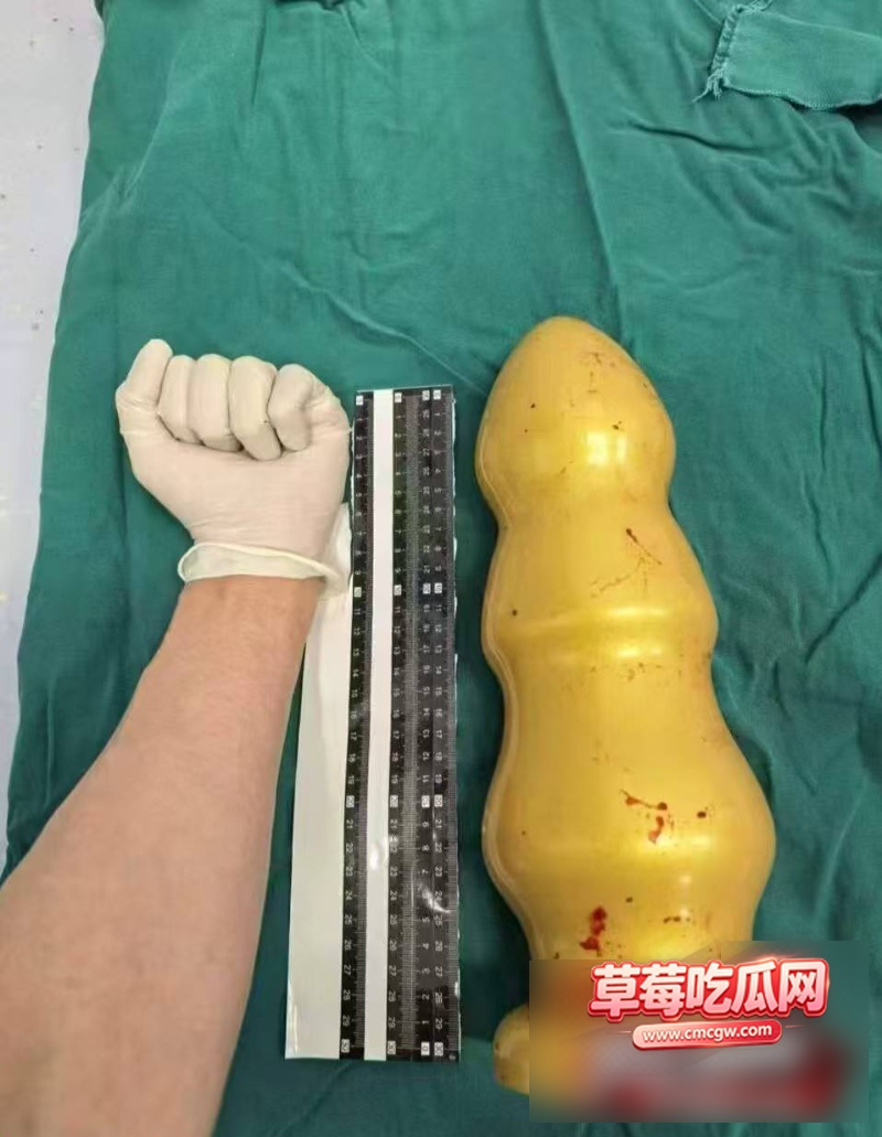 重口猎奇40厘米巨物毒龙2 重口猎奇40厘米巨物毒龙2