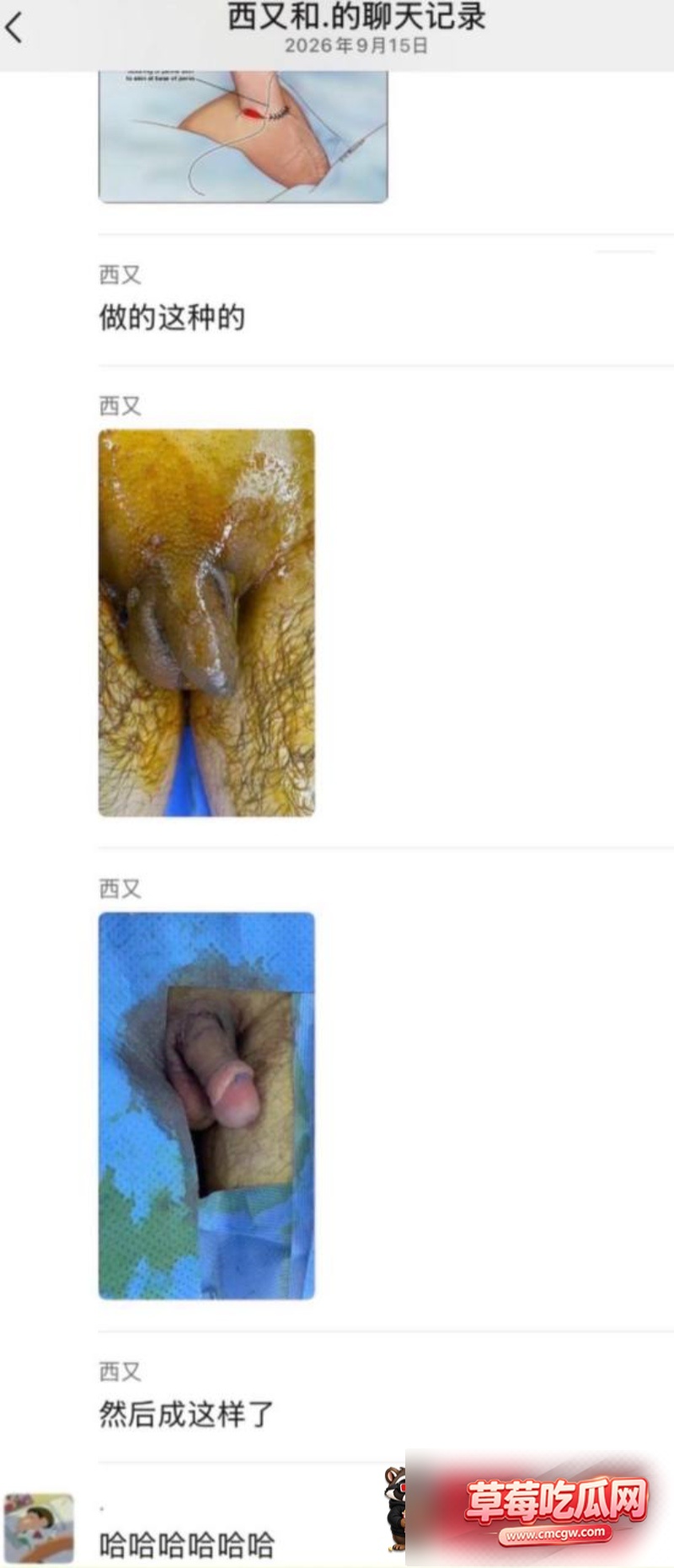 明星医美翻车43 明星医美翻车43