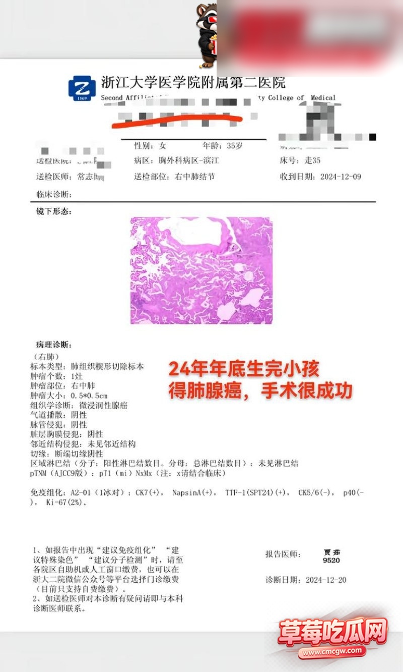 田娇 15